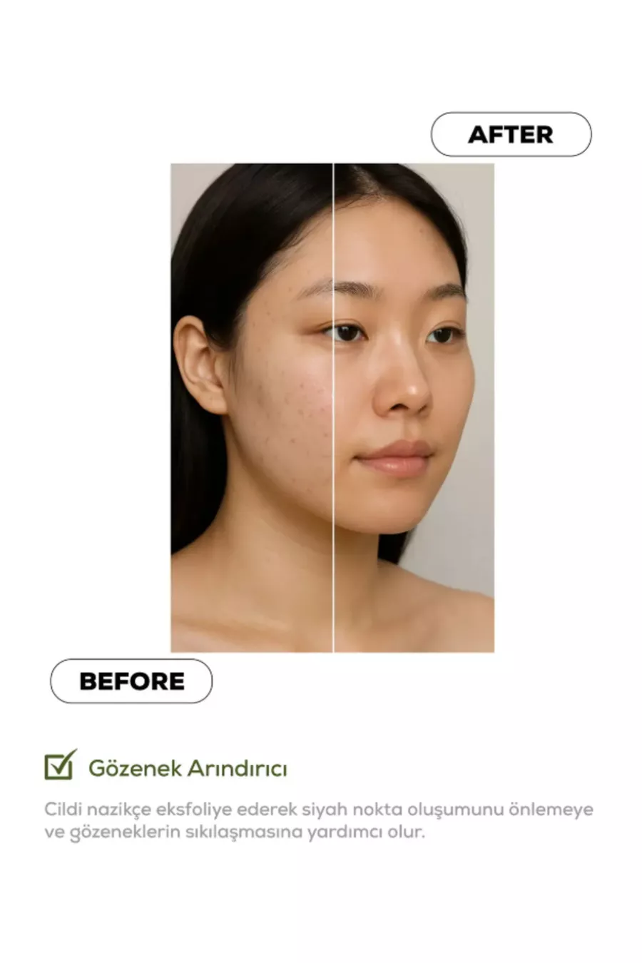Acide Salicylique, Gel Nettoyant Visage Anti-Acné | Contre les Pores et les Points Noirs | Gel Nettoyant pour Peaux Grasses  ml